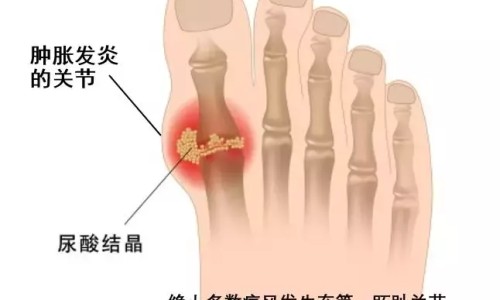 心血管病人能喝藏红花网 - 心血管病人能喝藏红花水吗,心血管病人可以喝咖啡吗